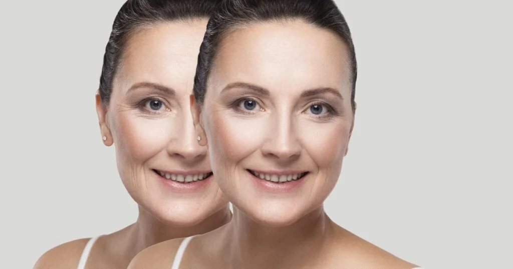 Gua Sha Before and After: Transformations That Speak Volumes